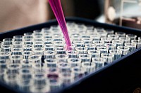 DNA Laboranalysen